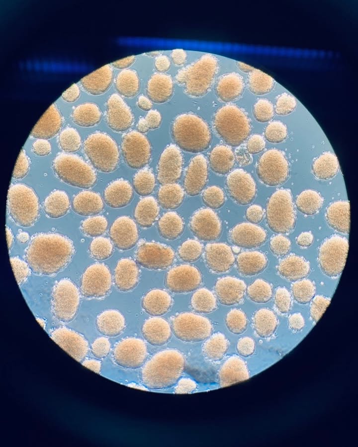 A field of pancreatic islets, dithizone-stained, viewed through a microscope eyepiece.